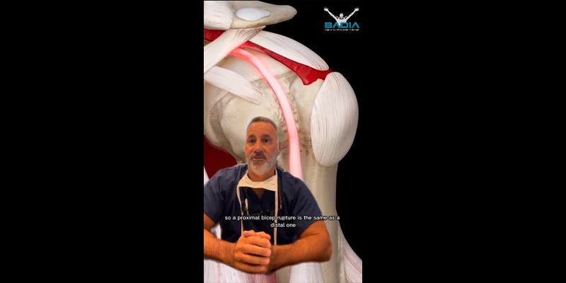 Orthopedic Surgeon Explains: Proximal Biceps Rupture Using 3D4Medical Animation